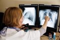 la-junta-confirma-tuberculosis-en-dos-trabajadores-de-una-explotacion-en-segovia,-uno-de-los-cuales-ha-fallecido